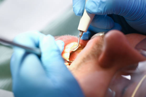 Best Mobile Emergency Dentist in Black Diamond, FL