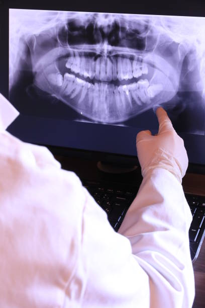 Best Broken or Cracked Tooth Emergency Dentist in Black Diamond, FL