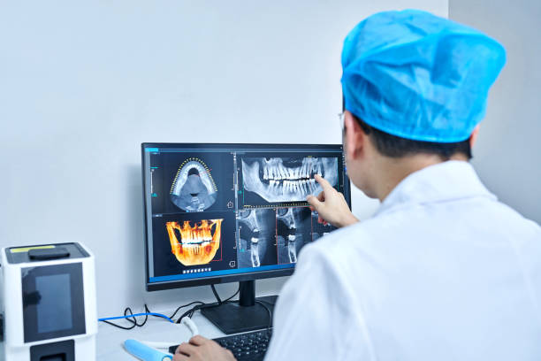 Best Emergency Dental Care for Abscessed Tooth in Black Diamond, FL